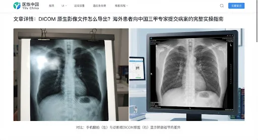 A side by side medical illustration showing the blurred, low-resolution phone photograph of a physical chest X-ray film with harsh window light glare, reflection artifacts, and moire interference patterns, making pulmonary nodules completely invisible to clinical specialists in a modern diagnostic setting.